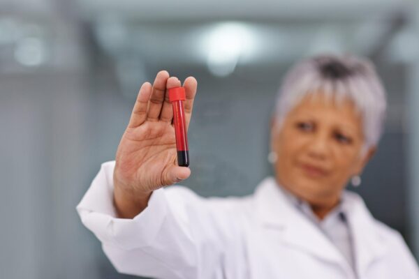 Trigliceridele și menopauza: de ce valorile se pot modifica după 50 de ani
